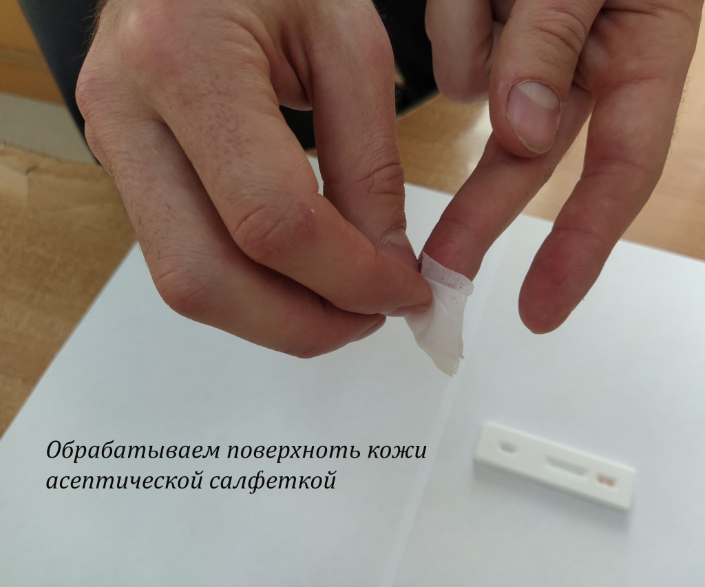 экспресс-тест на ВИЧ