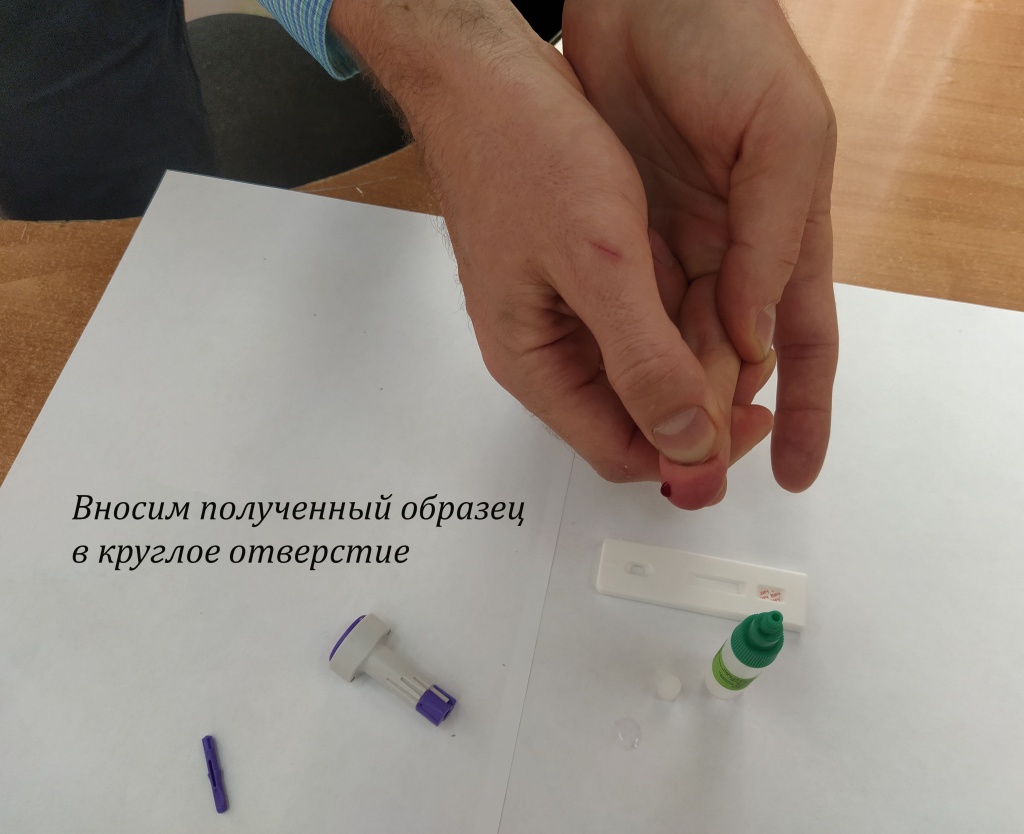 экспресс-тест на ВИЧ